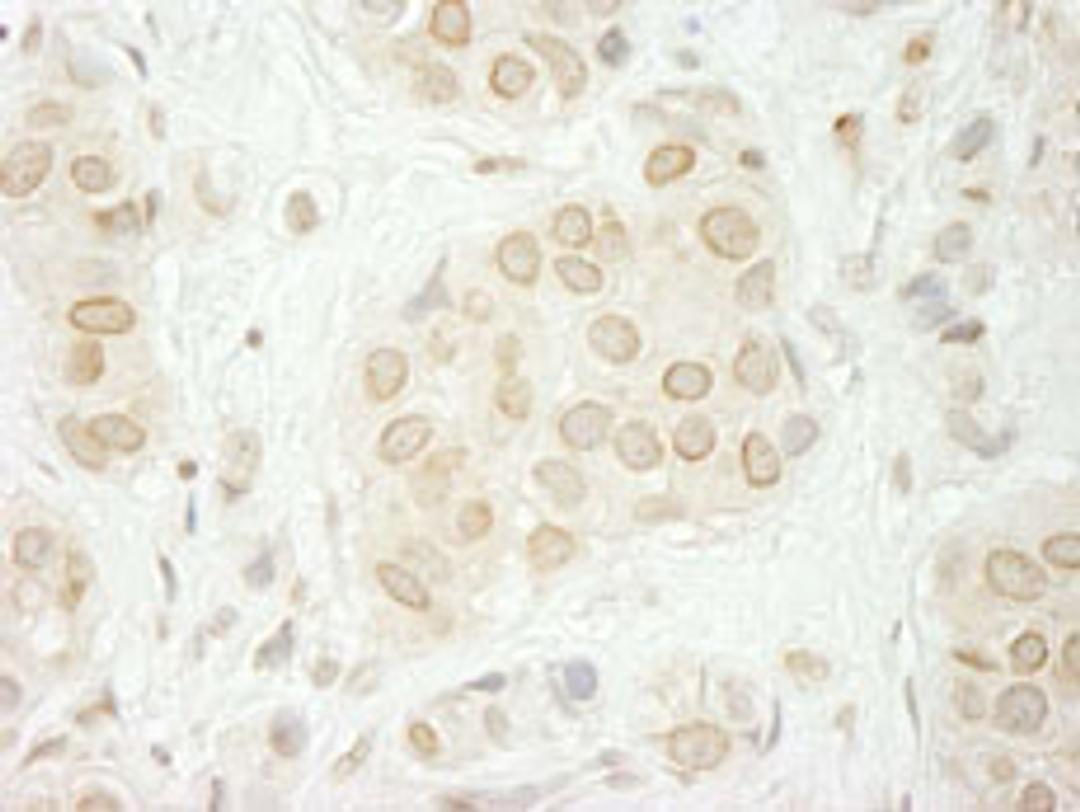 Detection of human LAP1B immunohistochemistry.