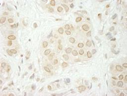 Detection of human LAP1B immunohistochemistry.