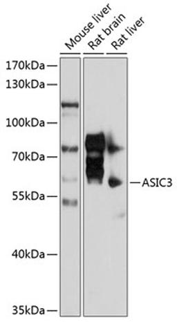 Western blot - ASIC3 antibody (A10268)