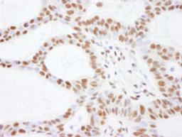 Detection of human SMARCC2/BAF170 by immunohistochemistry.