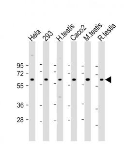 Western Blot at 1:2000 dilution Lane 1: Hela whole cell lysate Lane 2: 293 whole cell lysate Lane 3: human testis lysate Lane 4: Caco2 whole cell lysate Lane 5: mouse testis lysate Lane 6: rat testis lysate Lysates/proteins at 20 ug per lane.