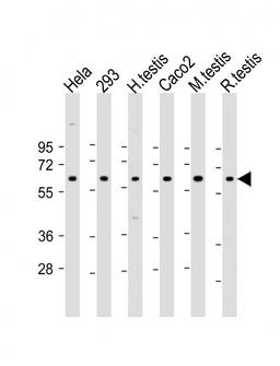 Western Blot at 1:2000 dilution Lane 1: Hela whole cell lysate Lane 2: 293 whole cell lysate Lane 3: human testis lysate Lane 4: Caco2 whole cell lysate Lane 5: mouse testis lysate Lane 6: rat testis lysate Lysates/proteins at 20 ug per lane.