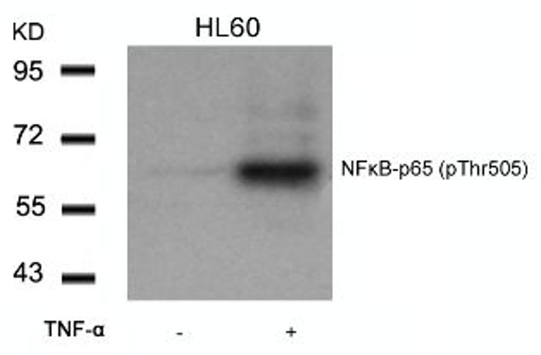 Western blot analysis of lysed extracts from HL60 cells untreated or treated with TNF-&#945; using NF&#954;B-p65 (Phospho-Thr505).