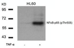 Western blot analysis of lysed extracts from HL60 cells untreated or treated with TNF-&#945; using NF&#954;B-p65 (Phospho-Thr505).