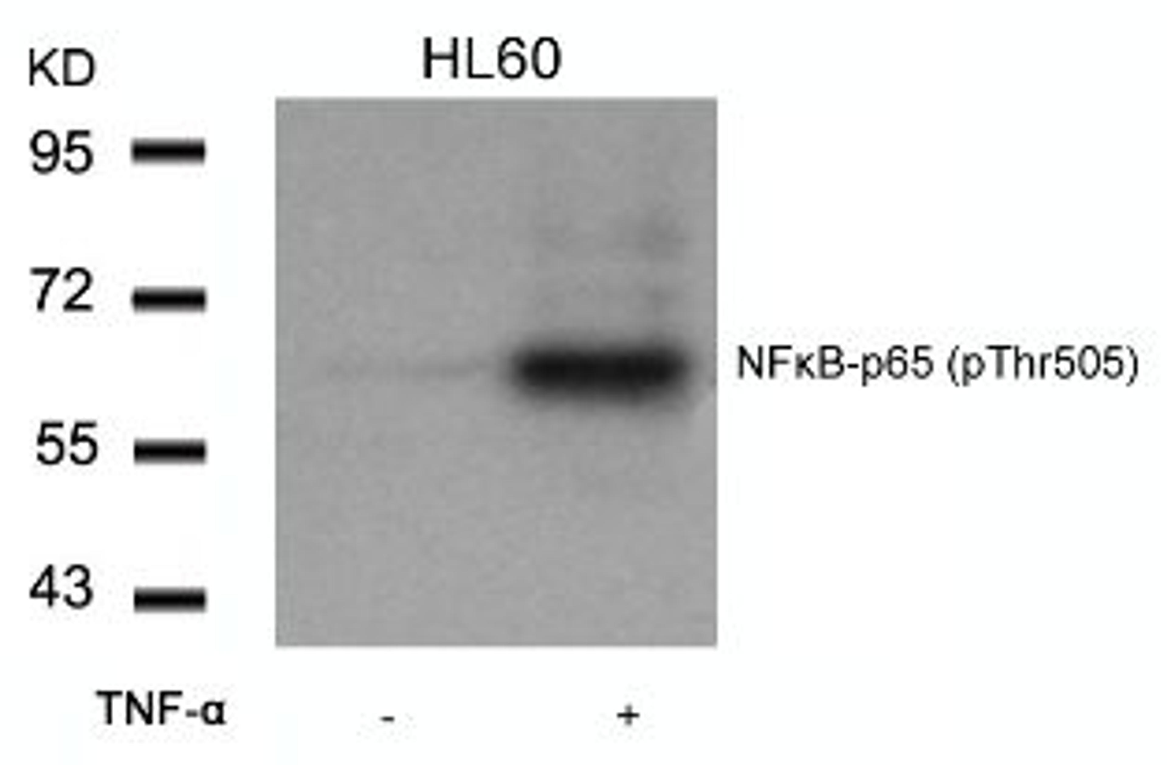 Western blot analysis of lysed extracts from HL60 cells untreated or treated with TNF-α using NFκB-p65 (Phospho-Thr505).