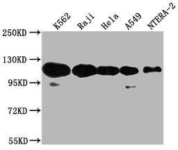 Western Blot. Positive WB detected in: K562 whole cell lysate, Raji whole cell lysate, Hela whole cell lysate, A549 whole cell lysate, NTERA-2 whole cell lysate. All lanes: PARP1 antibody at 1:2000. Secondary. Goat polyclonal to rabbit IgG at 1/50000 dilution. Predicted band size: 114 kDa. Observed band size: 114 kDa. 
