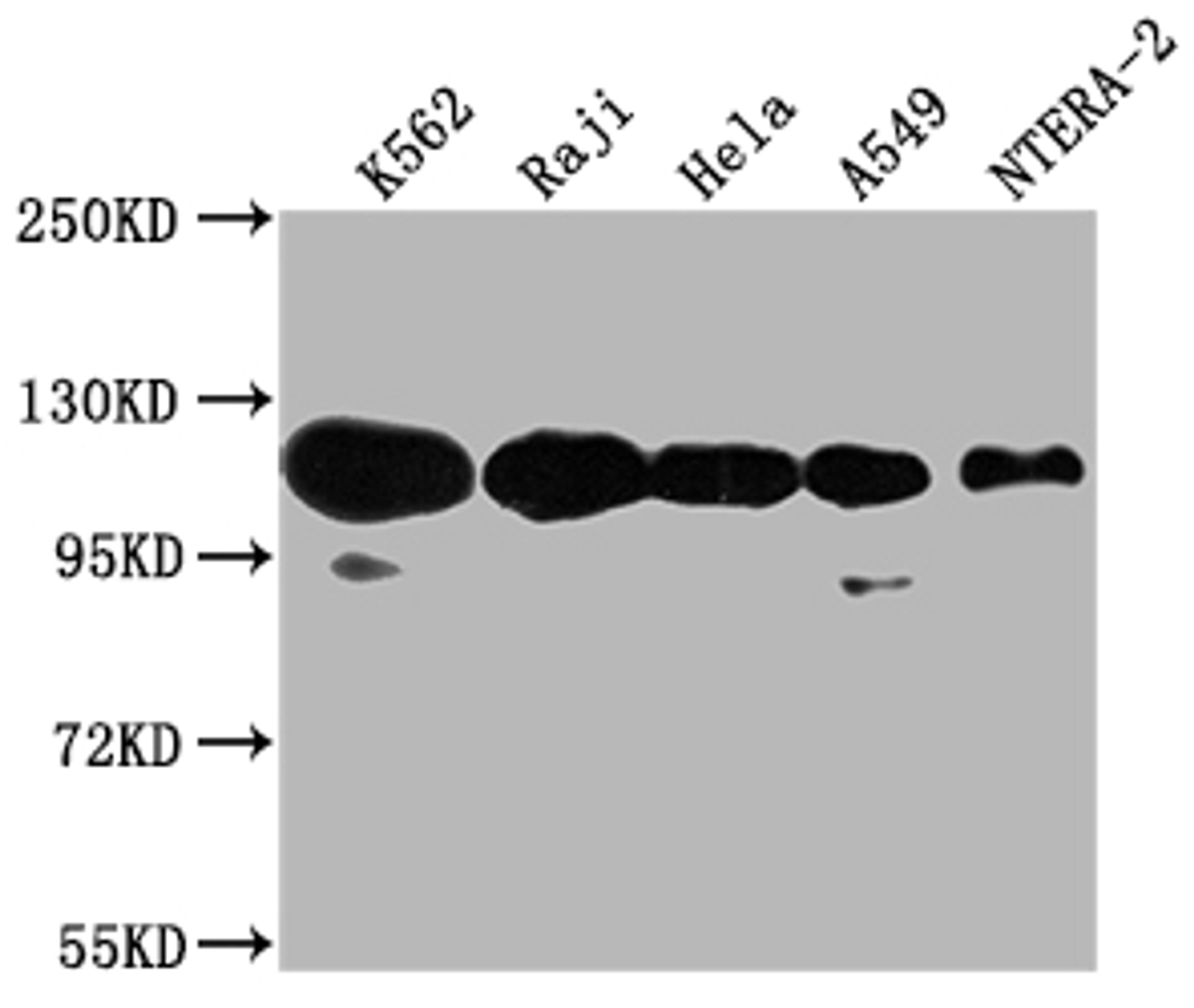 Western Blot. Positive WB detected in: K562 whole cell lysate, Raji whole cell lysate, Hela whole cell lysate, A549 whole cell lysate, NTERA-2 whole cell lysate. All lanes: PARP1 antibody at 1:2000. Secondary. Goat polyclonal to rabbit IgG at 1/50000 dilution. Predicted band size: 114 kDa. Observed band size: 114 kDa. 