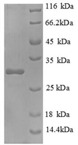 (Tris-Glycine gel) Discontinuous SDS-PAGE (reduced) with 5% enrichment gel and 15% separation gel.