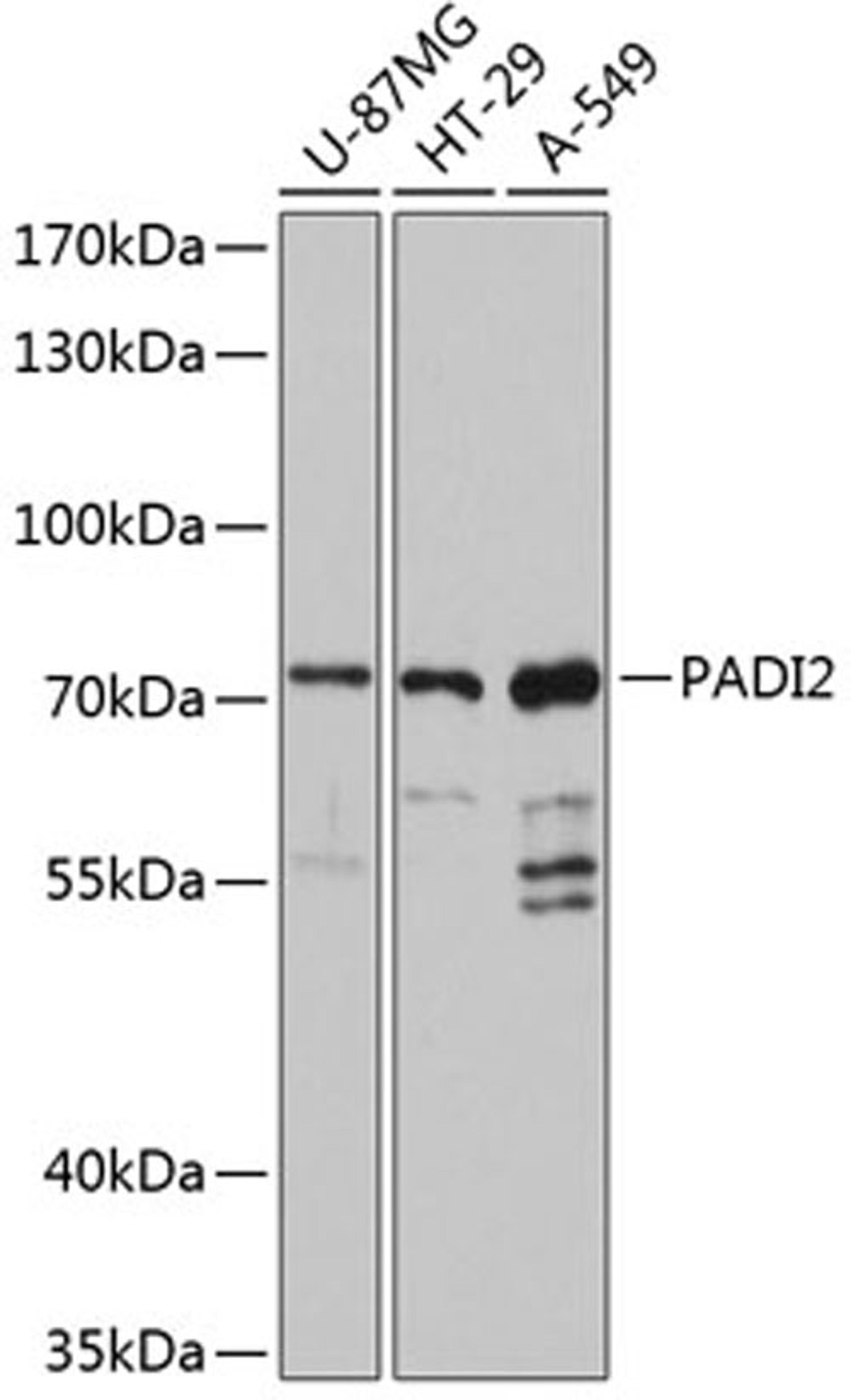 Western blot - PADI2 antibody (A12236)