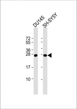 Western Blot at 1:1000 dilution Lane 1: DU145 whole cell lysate Lane 2: SH-SY5Y whole cell lysate Lysates/proteins at 20 ug per lane.