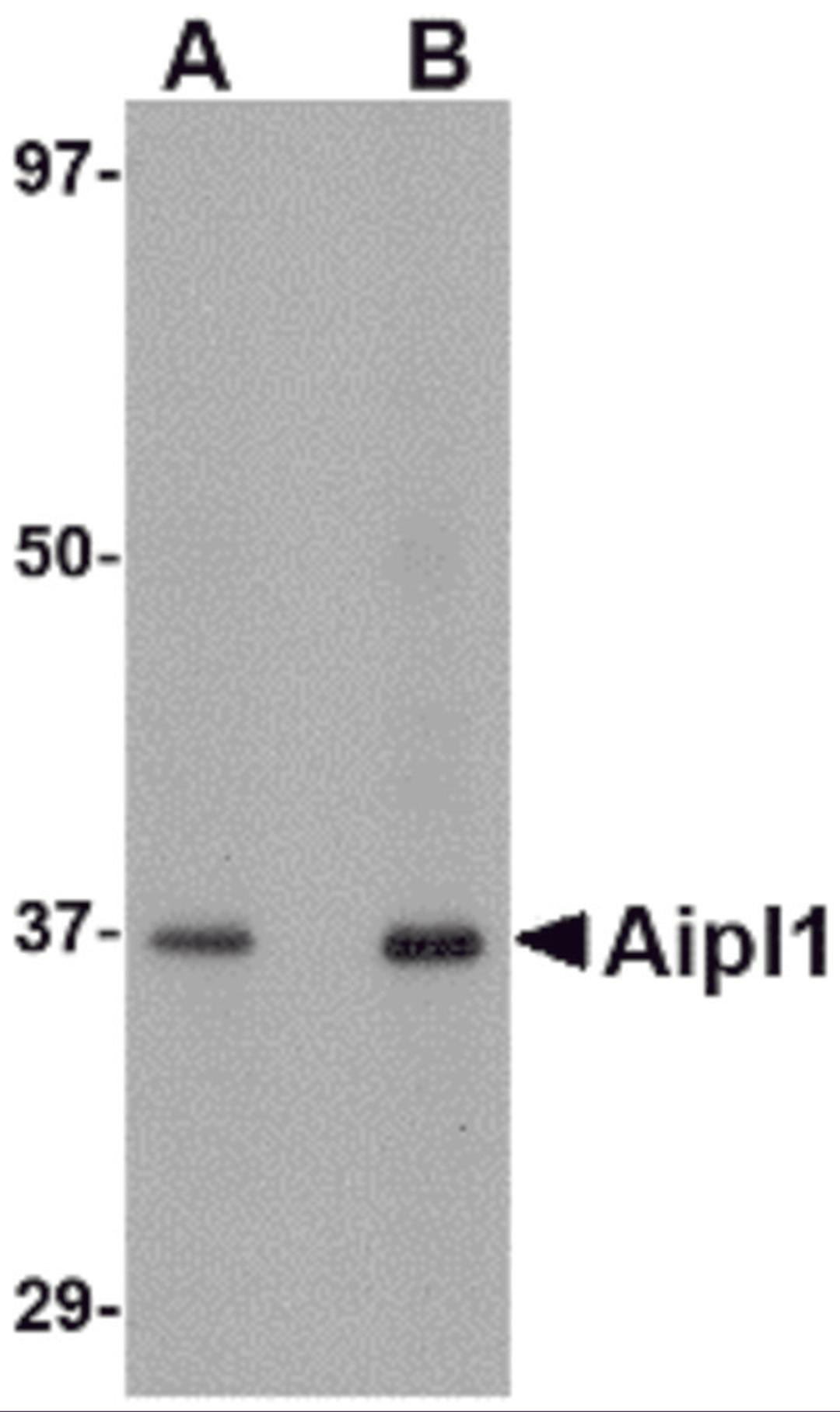 Western blot analysis of Aipl1 in human brain tissue lysate with Aipl1 antibody at (A) 1 and (B) 2 &#956;g/mL.