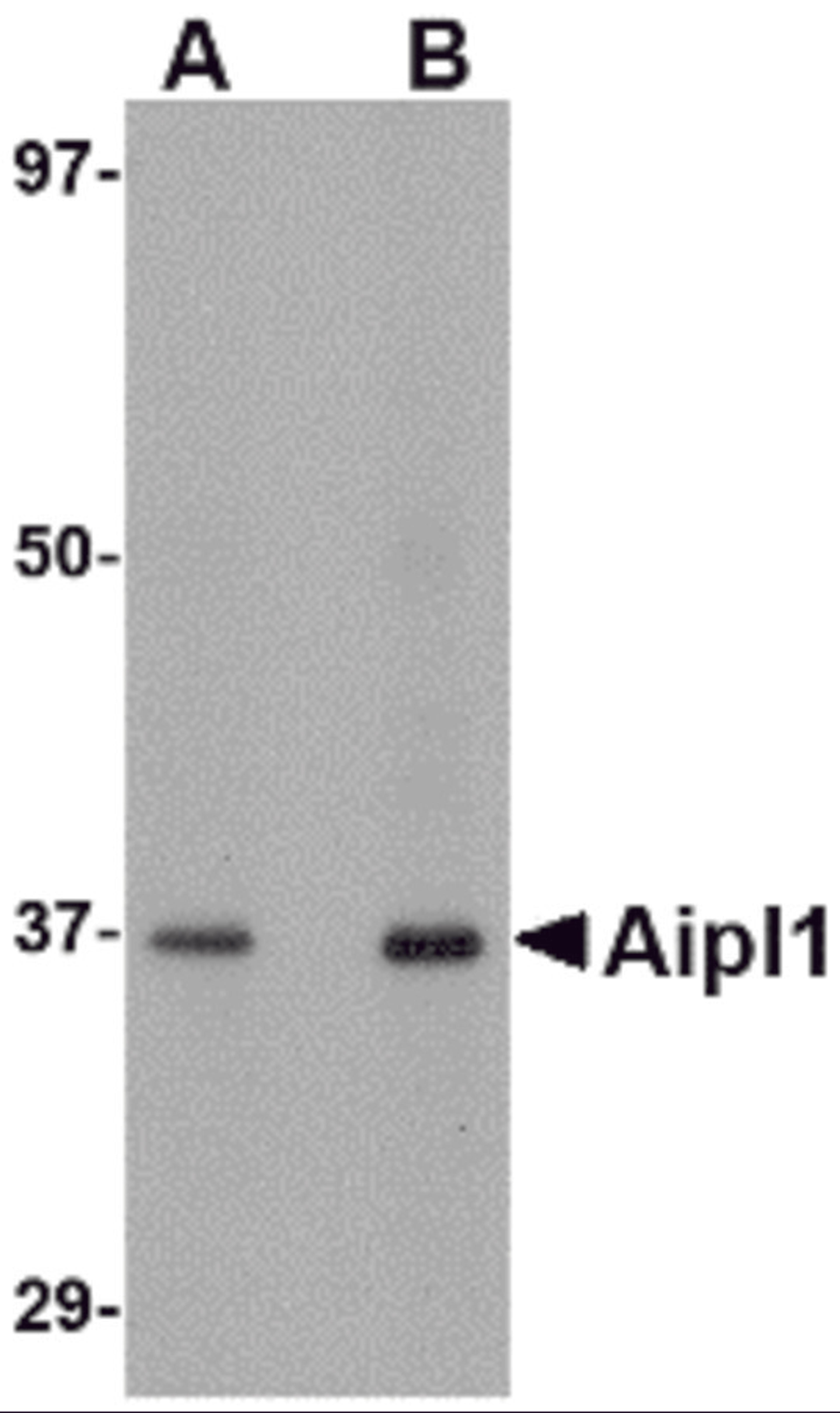 Western blot analysis of Aipl1 in human brain tissue lysate with Aipl1 antibody at (A) 1 and (B) 2 μg/mL.