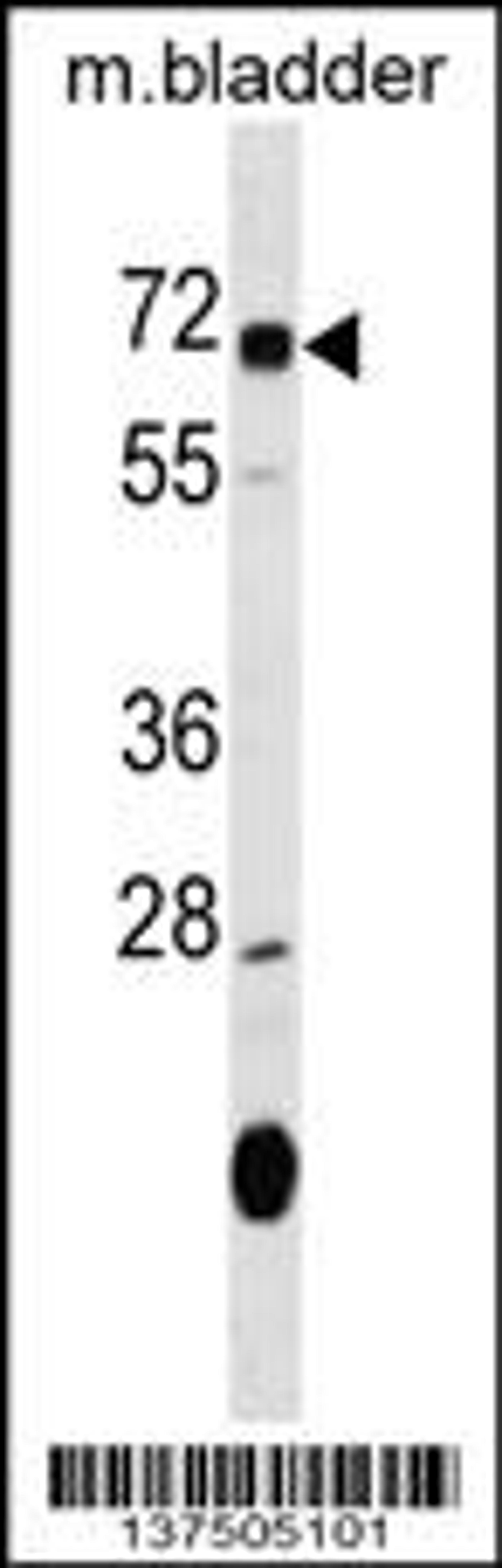 Western blot analysis in mouse bladder tissue lysates (35ug/lane).