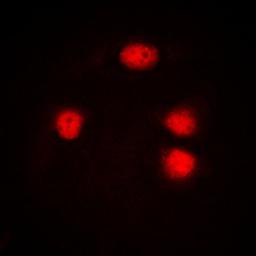 Immunofluorescense analysis of Jurkat cells using ZIC1/2/3 antibody