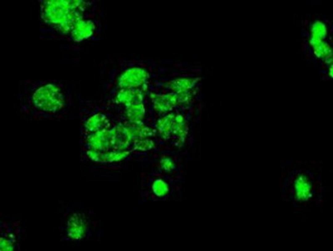 Immunocytochemistry/Immunofluorescence: Kindlin-2 Antibody (9E4) [NBP1-47745] - Immunofluorescent staining of HepG2 cells using anti-Kindlin-2 mouse monoclonal antibody.