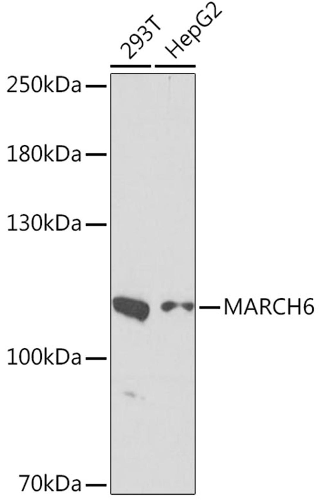 Western blot - MARCH6 Rabbit pAb (A16097)