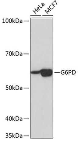 Western blot - G6PD Rabbit mAb (A11234)