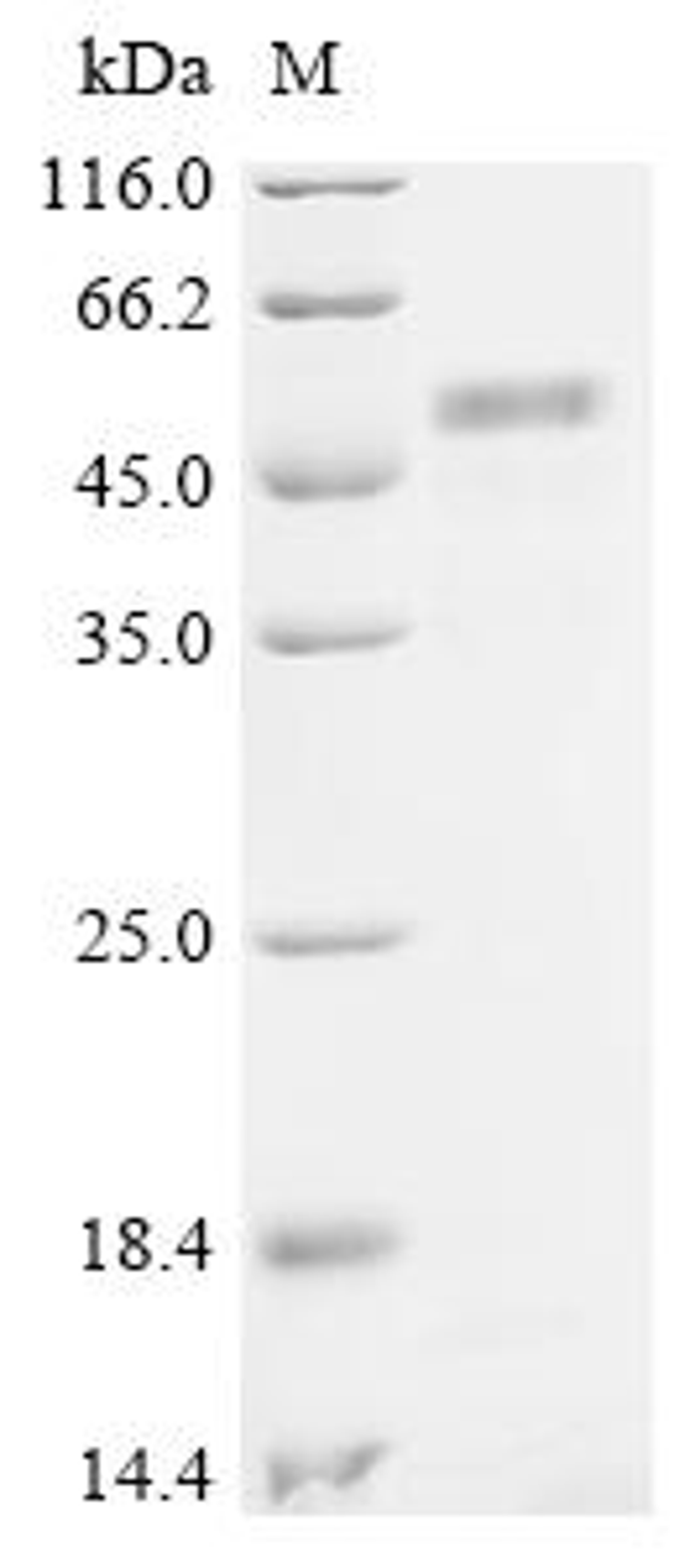 (Tris-Glycine gel) Discontinuous SDS-PAGE (reduced) with 5% enrichment gel and 15% separation gel.