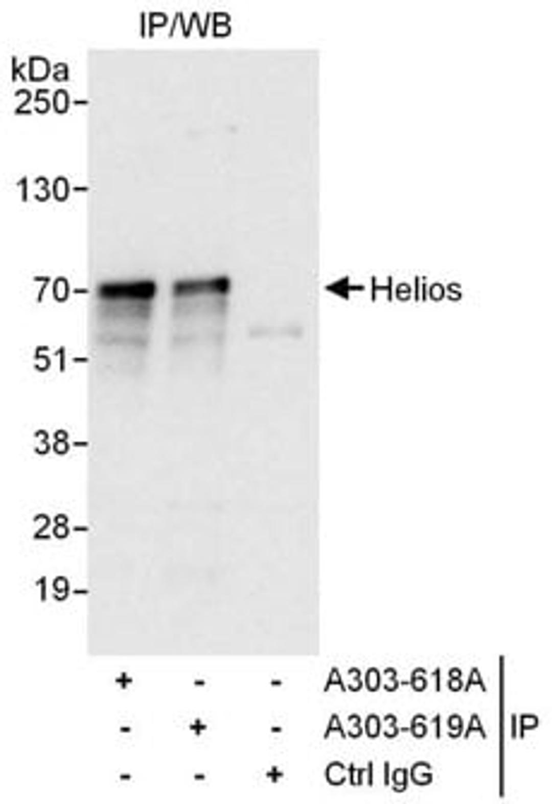 Detection of human Helios by western blot of immunoprecipitates.