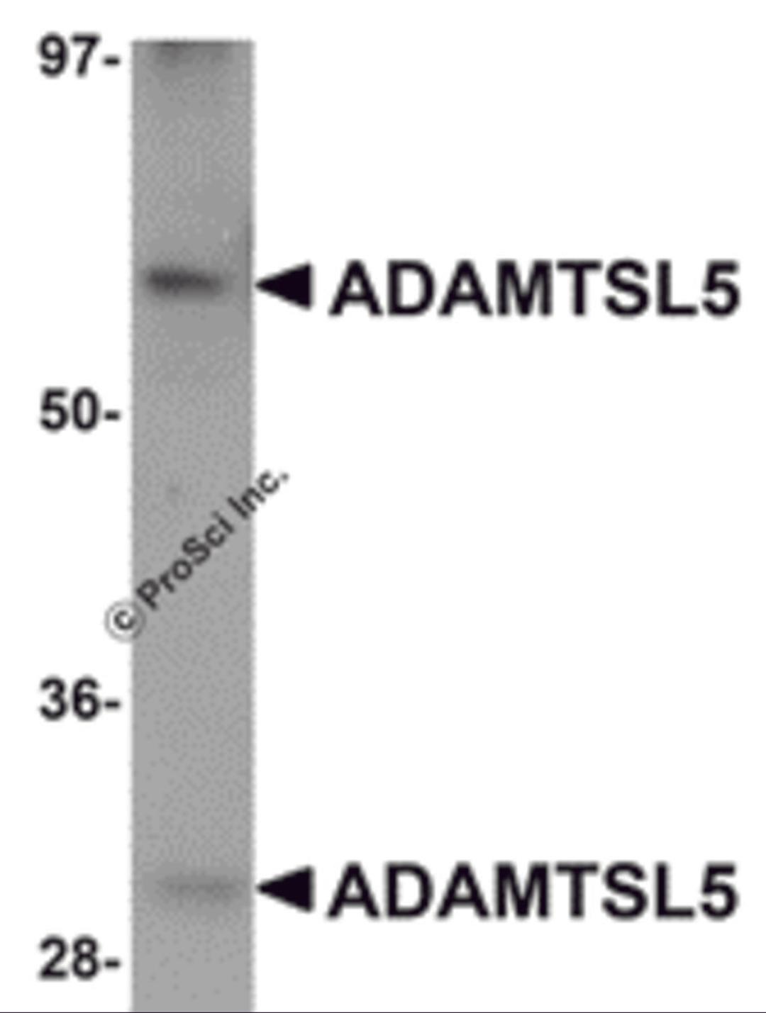 Western blot analysis of ADAMTSL5 in human skeletal muscle tissue lysate with ADAMTSL5 antibody at 1 μg/mL.