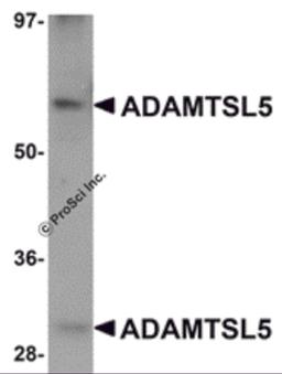 Western blot analysis of ADAMTSL5 in human skeletal muscle tissue lysate with ADAMTSL5 antibody at 1 μg/mL.