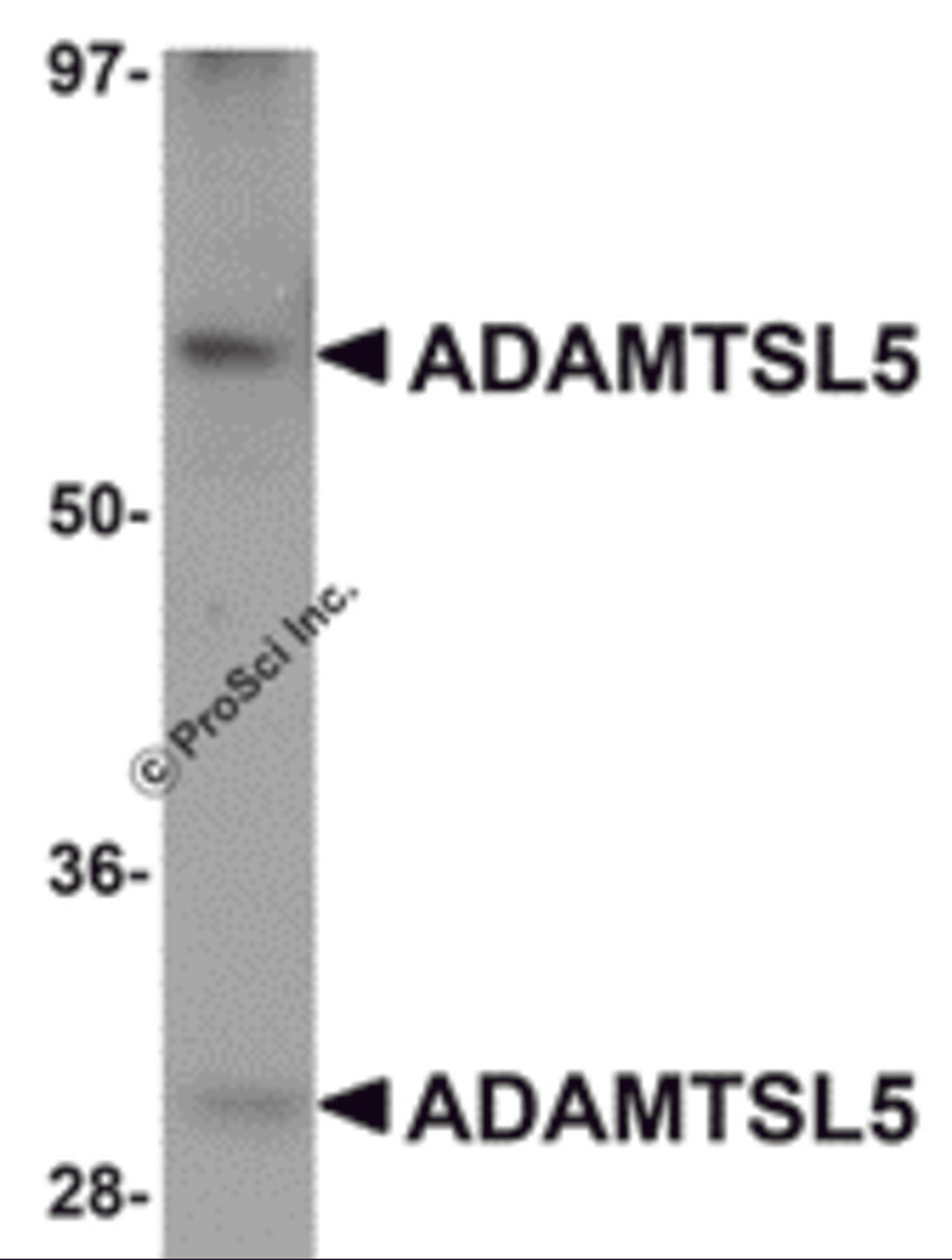 Western blot analysis of ADAMTSL5 in human skeletal muscle tissue lysate with ADAMTSL5 antibody at 1 μg/mL.