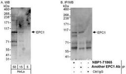 Western Blot: EPC1 Antibody [NBP1-71865] - Whole cell lysate (5, 15 and 50 mcg for WB; 1 mg for IP, 20% of IP loaded) from HeLa cells.   Affinity purified rabbit anti-EPC1 antibody used for WB at 0.1 mcg/ml (A) and 1 mcg/ml (B) and used for IP at 6 mcg/mg lysate.  EPC1 was also immunoprecipitated by another rabbit anti-EPC1 antibody.,