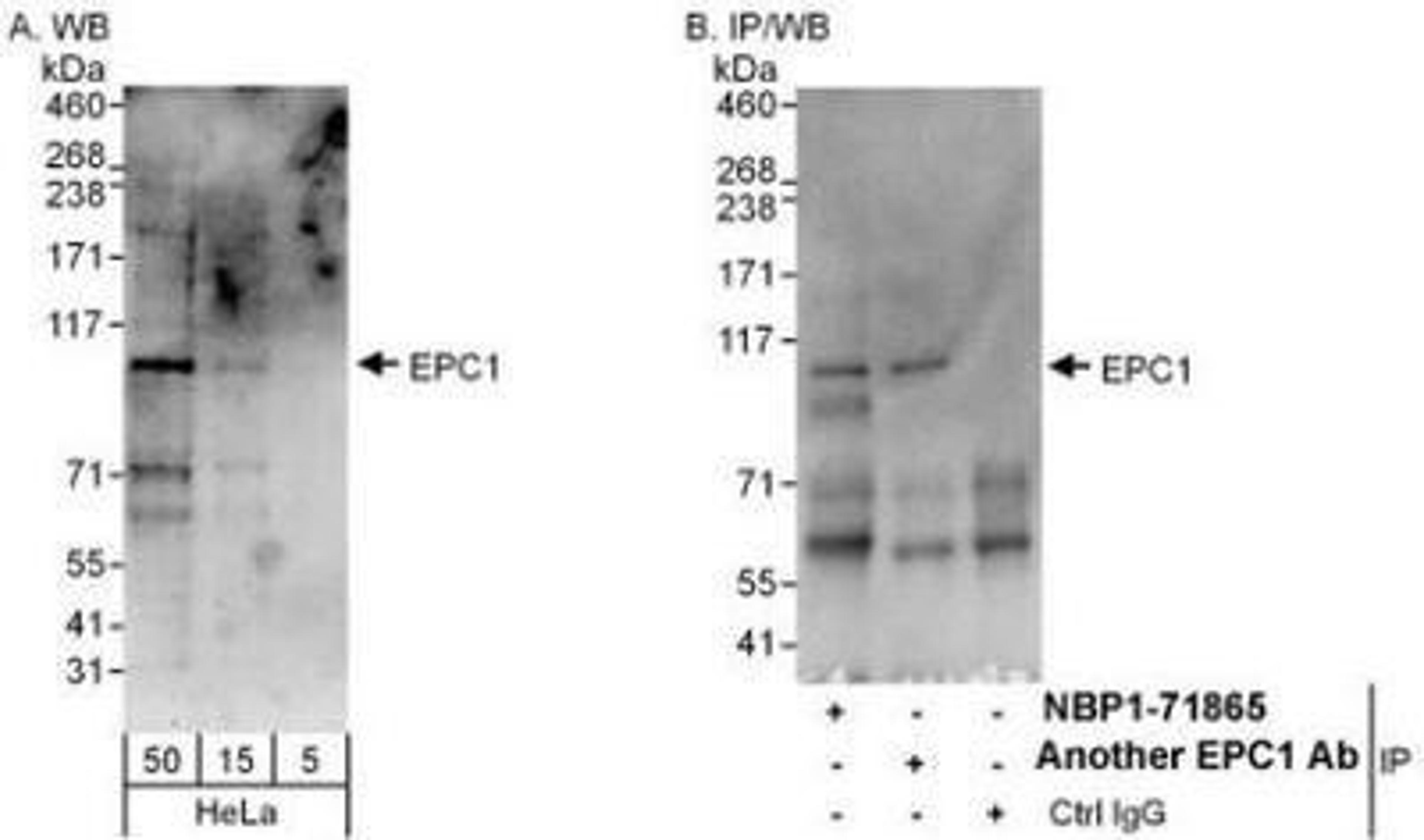 Western Blot: EPC1 Antibody [NBP1-71865] - Whole cell lysate (5, 15 and 50 mcg for WB; 1 mg for IP, 20% of IP loaded) from HeLa cells.   Affinity purified rabbit anti-EPC1 antibody used for WB at 0.1 mcg/ml (A) and 1 mcg/ml (B) and used for IP at 6 mcg/mg lysate.  EPC1 was also immunoprecipitated by another rabbit anti-EPC1 antibody.,