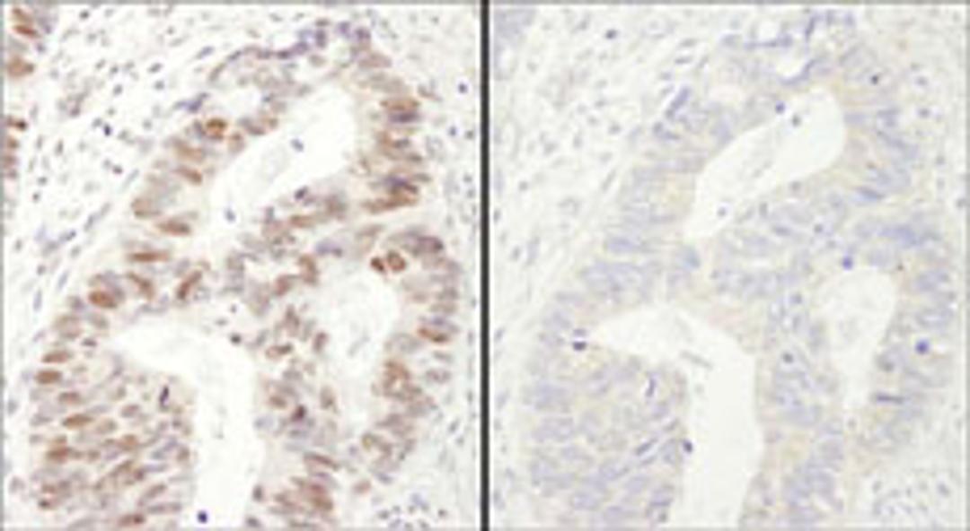 Detection of human Phospho MCM2 (S40/S41) by immunohistochemistry.