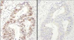 Detection of human Phospho MCM2 (S40/S41) by immunohistochemistry.