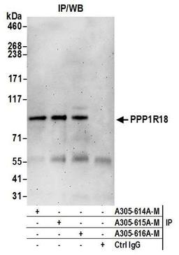 Detection of human PPP1R18 by WB of IP.