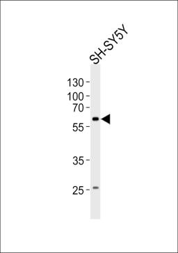 Western blot analysis of lysate from SH-SY5Y cell line, using PAK1 Antibody at 1:1000.