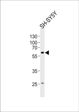 Western blot analysis of lysate from SH-SY5Y cell line, using PAK1 Antibody at 1:1000.