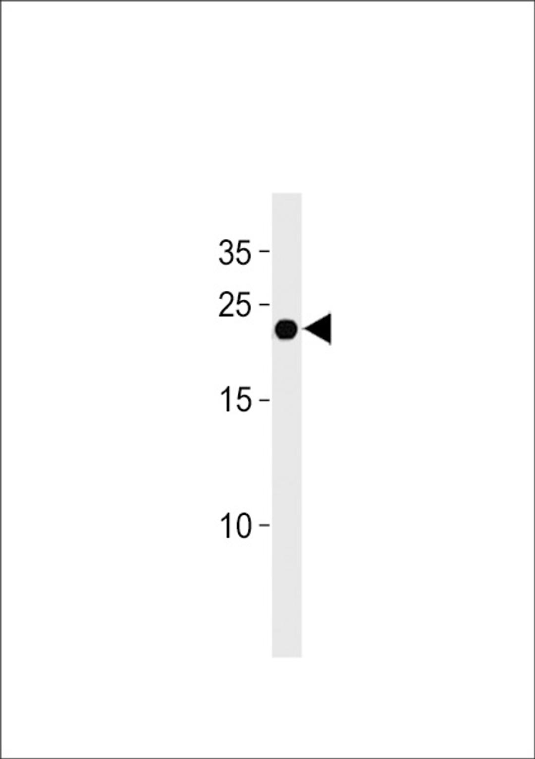 Western blot analysis in U937 cell line lysates (35ug/lane).