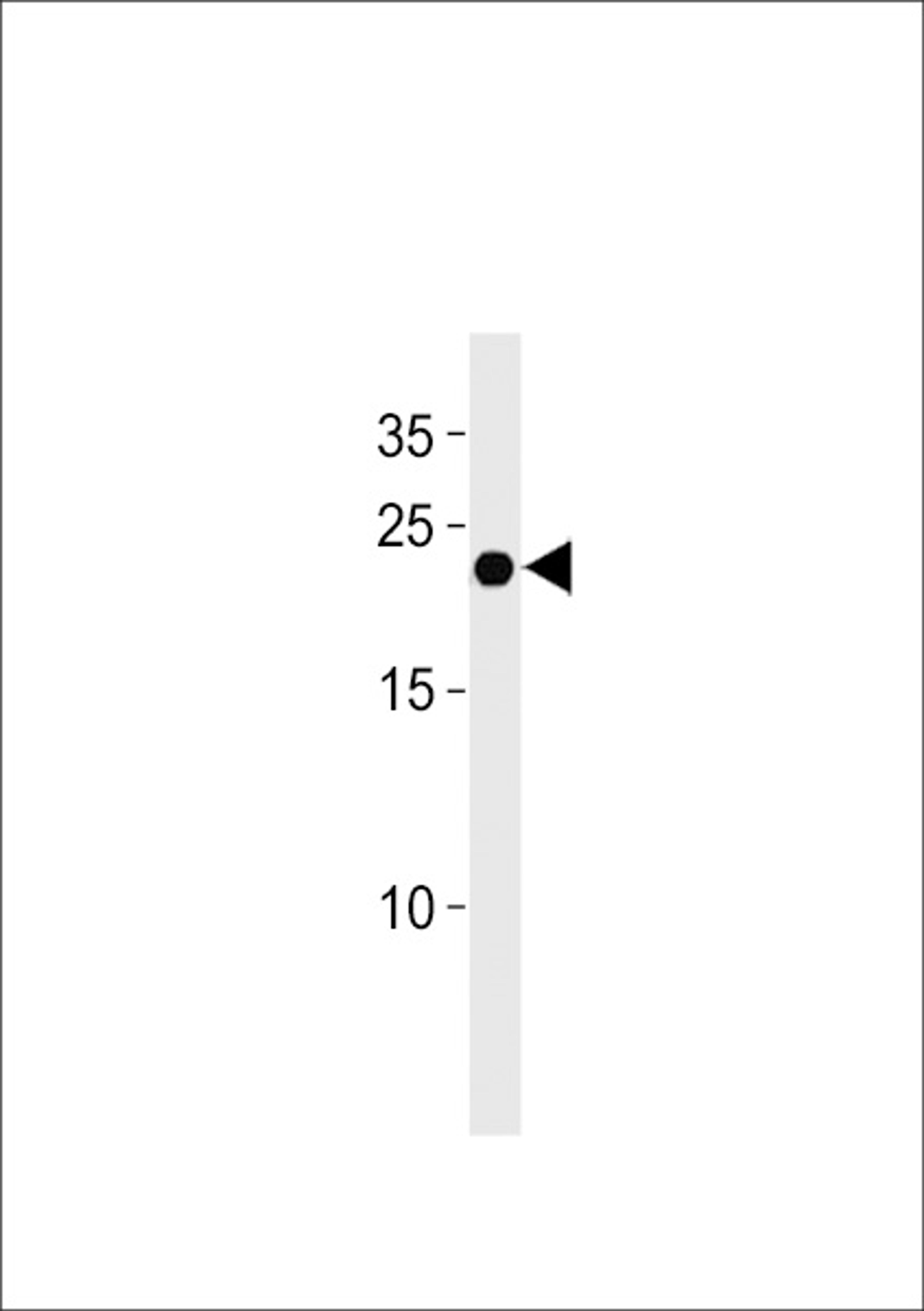 Western blot analysis in U937 cell line lysates (35ug/lane).