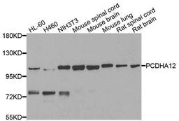 Western blot analysis of extracts of various cells using PCDHA12 antibody