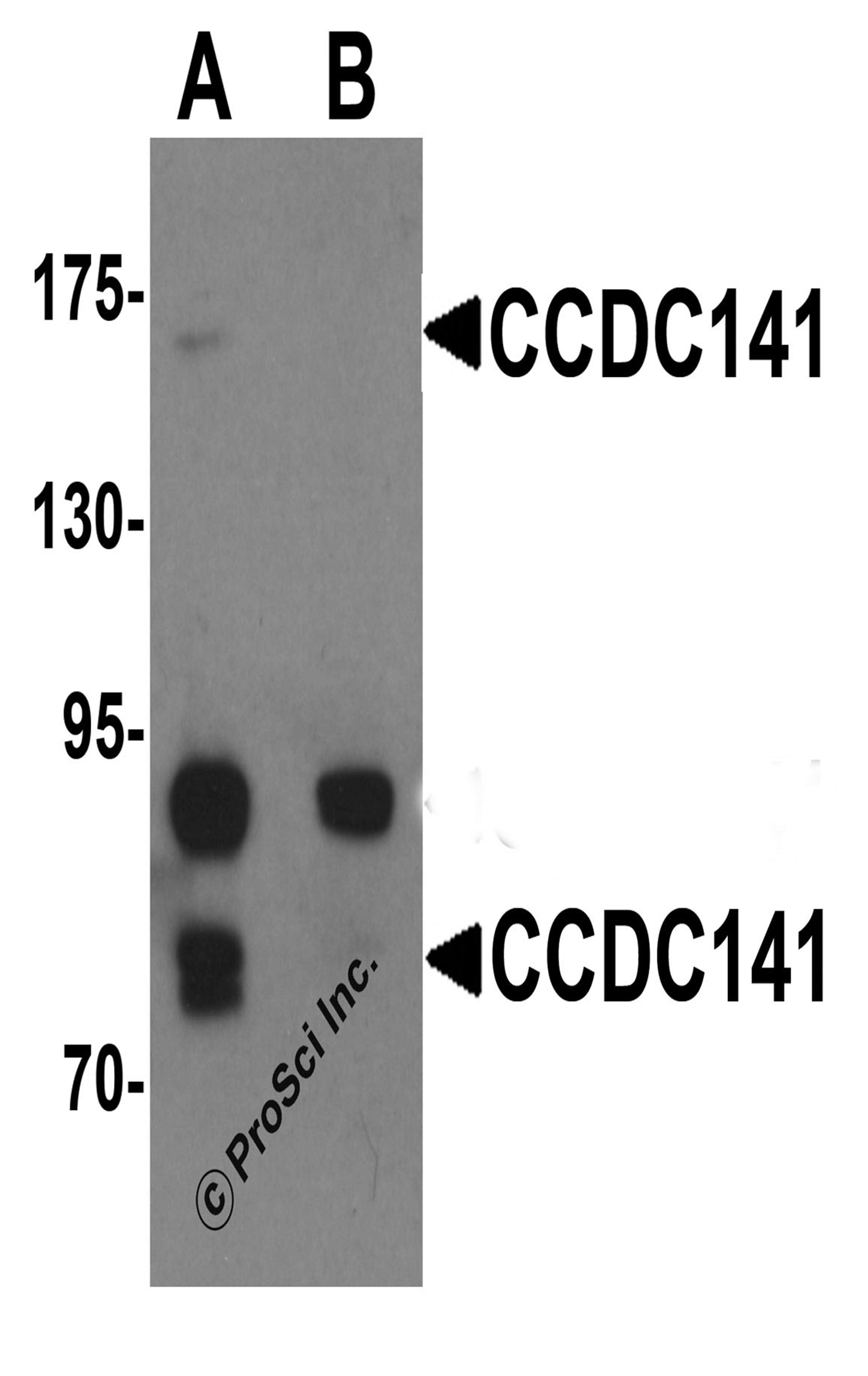 Western blot analysis of CCDC141 in SK-N-SH cell tissue lysate with CCDC141 antibody at 1 μg/mL in (A) the absence and (B) the presence of blocking peptide