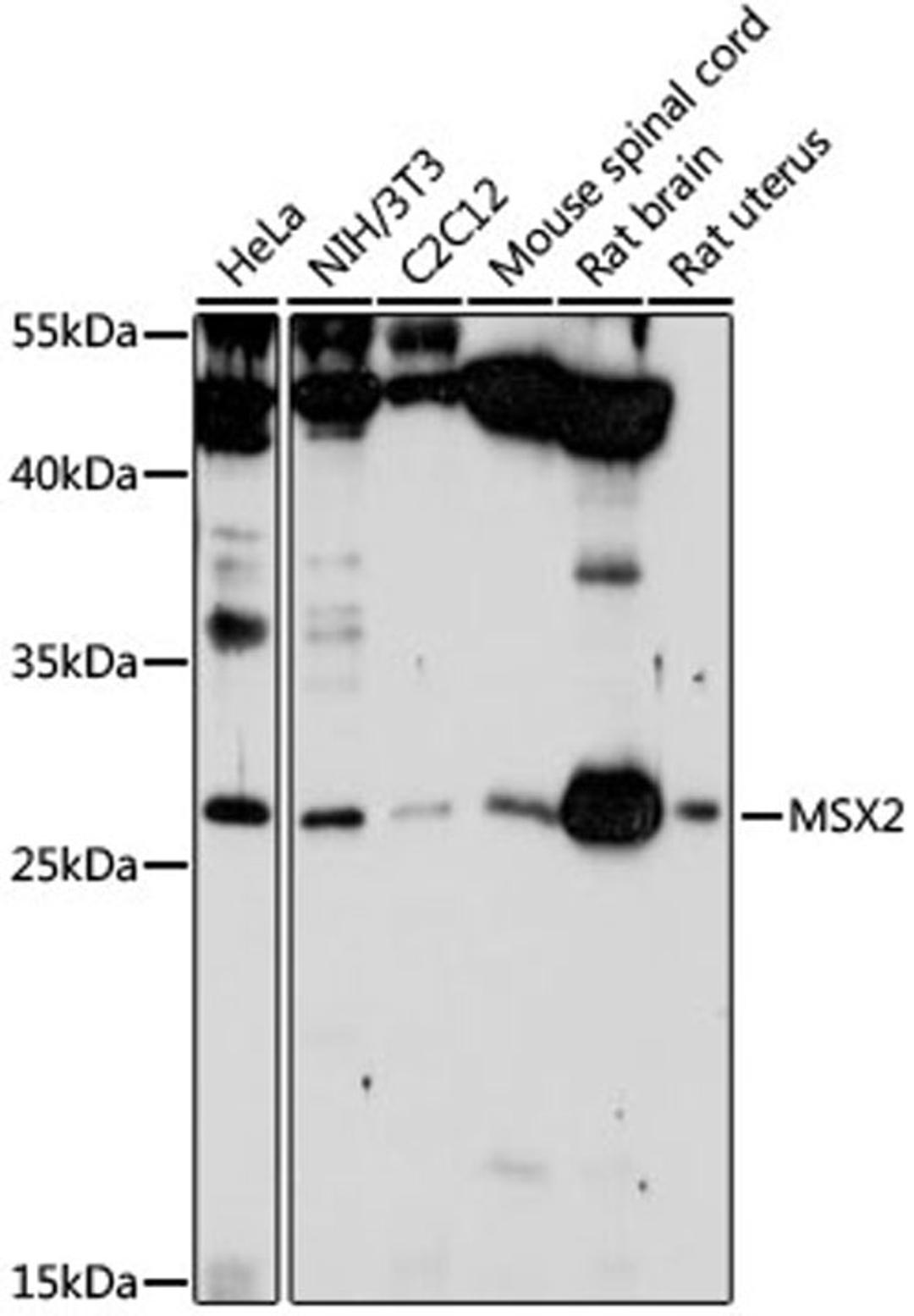 Western blot - MSX2 antibody (A2017)