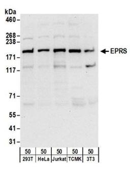 Detection of human and mouse EPRS by western blot.