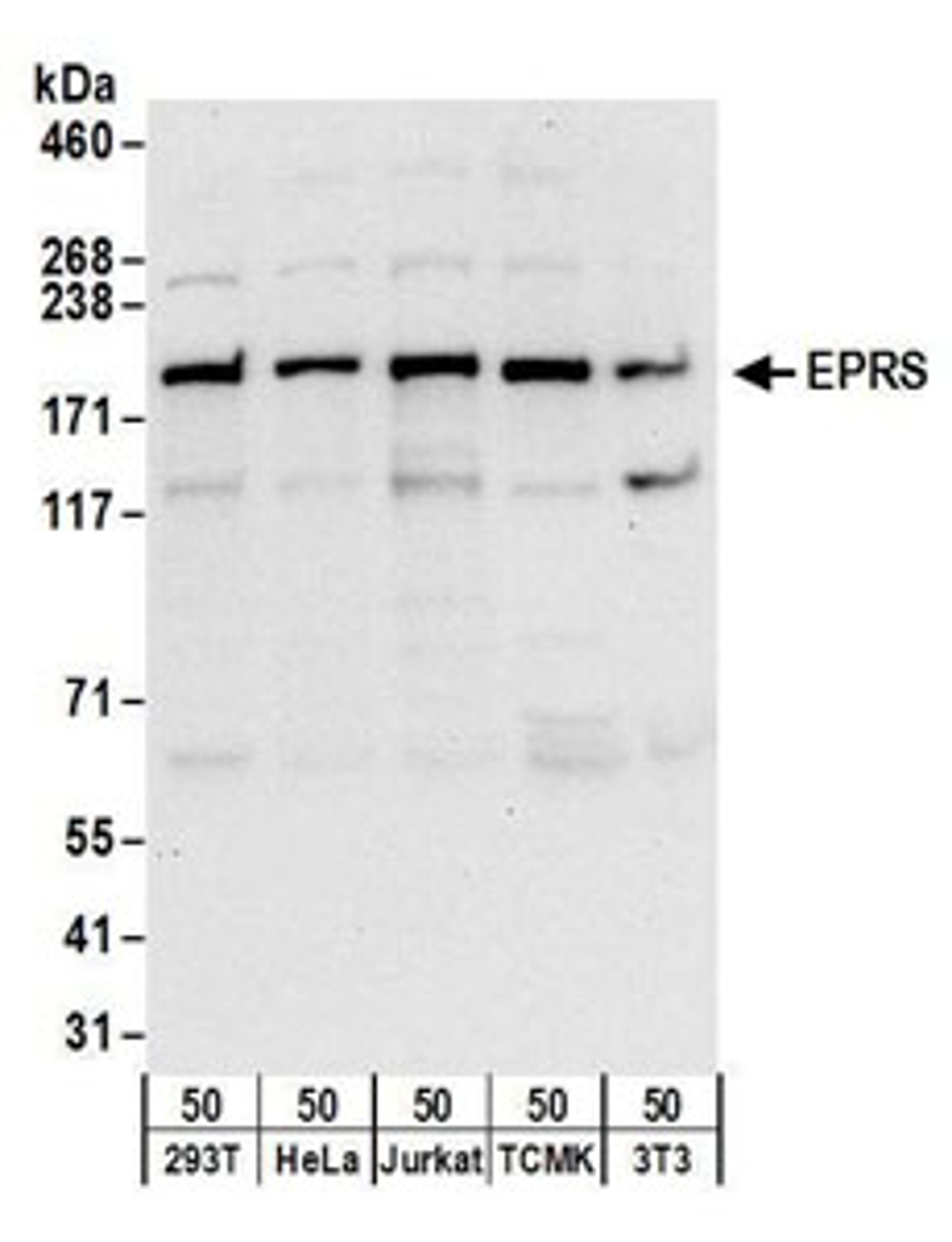 Detection of human and mouse EPRS by western blot.