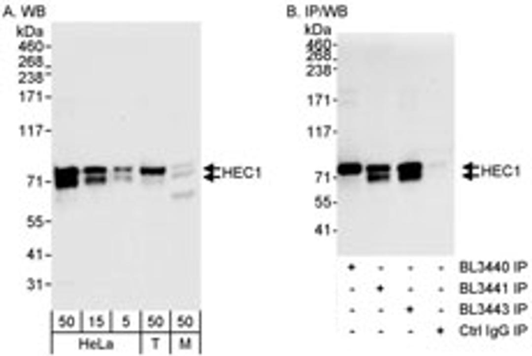 Detection of human and mouse HEC1 by western blot (h&m) and immunoprecipitation (h).