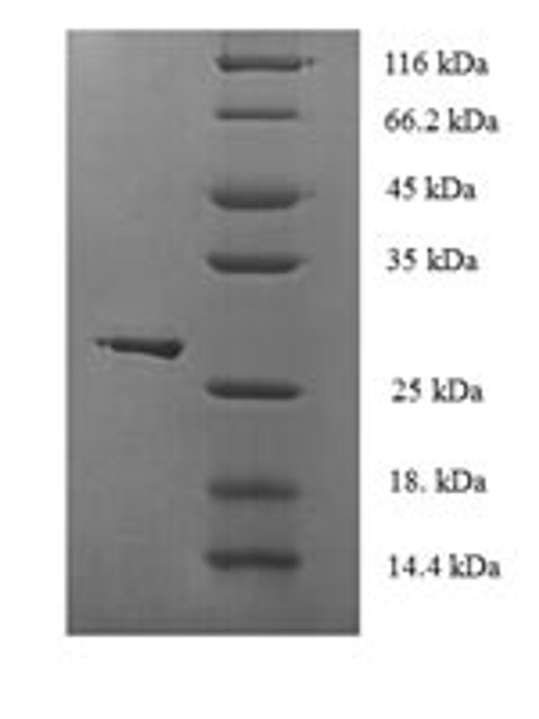 (Tris-Glycine gel) Discontinuous SDS-PAGE (reduced) with 5% enrichment gel and 15% separation gel.