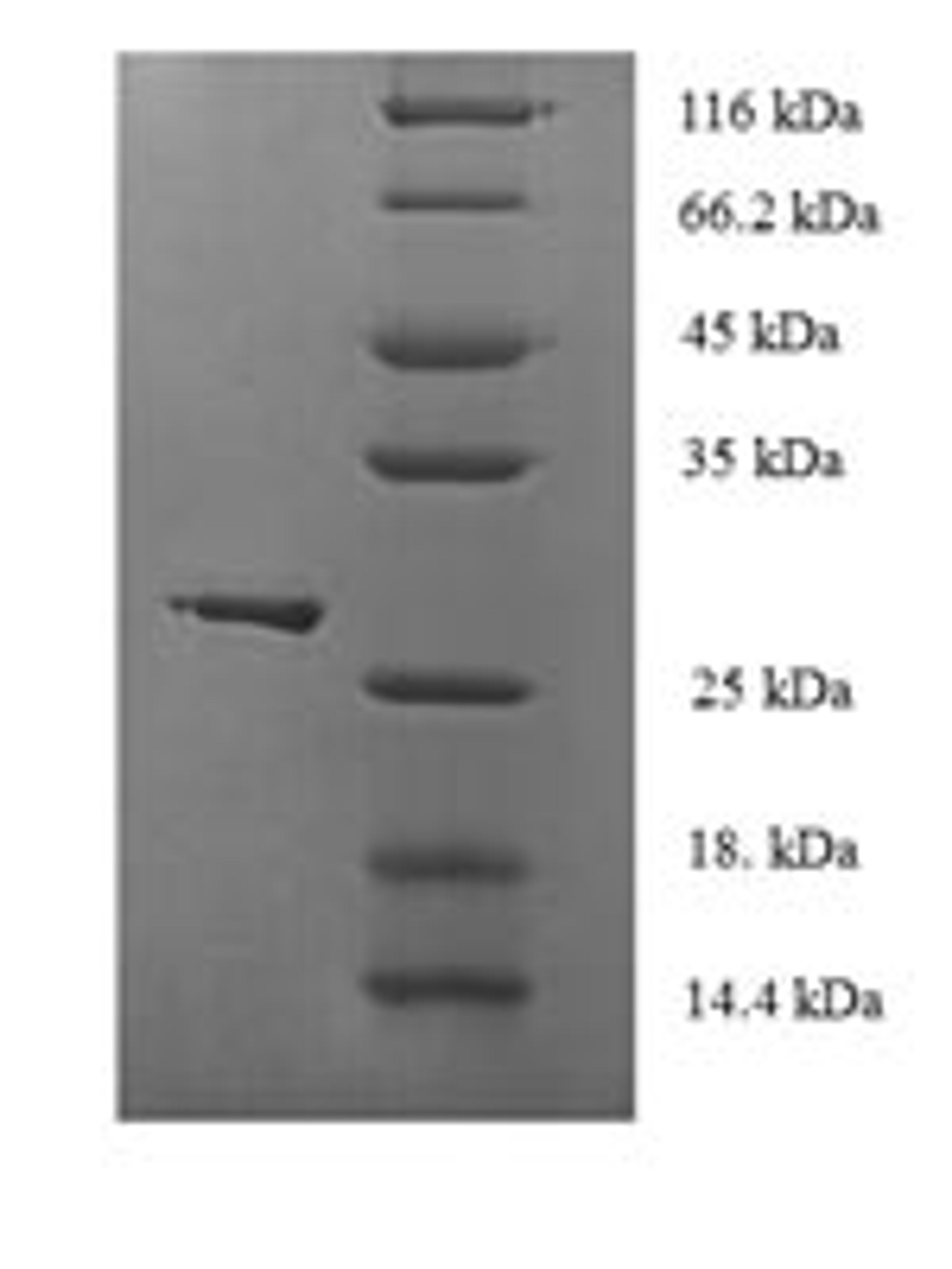 (Tris-Glycine gel) Discontinuous SDS-PAGE (reduced) with 5% enrichment gel and 15% separation gel.