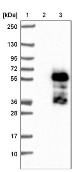 Western Blot: ELK4 Antibody [NBP1-87092] - Lane 1: Marker [kDa] 250, 130, 95, 72, 55, 36, 28, 17, 10<br/>Lane 2: Negative control (vector only transfected HEK293T lysate)<br/>Lane 3: Over-expression lysate (Co-expressed with a C-terminal myc-DDK tag (~3.1 kDa) in mammalian HEK293T cells, LY411912)