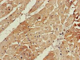 Immunohistochemistry of paraffin-embedded human heart tissue using CSB-PA002550LA01HU at dilution of 1:100