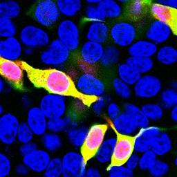 Immunocytochemistry/Immunofluorescence: mCherry Antibody [NBP2-25157] - HEK293 cells transfected in the same way and viewed in the confocal microscope. Most HEK293 cells are not transfected so only the nucleus of these cells can be visualized with a blue DNA stain. Cells which are transfected with mCherry are red. Staining with NBP2-25157 is shown in Green. Green antibody staining is only seen in cells which express mCherry, as expected, and the superimposition of the green and red signals results in an orange signal. Interestingly, stronger mCherry staining is seen in the nucleus, possibly due to degradation of some mCherry molecules to release the low molecular weight mCherry fluorochrome. Blot and transfected cells courtesy of the Semple-Rowland lab at the University of Florida.