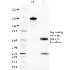 SDS-PAGE Analysis of Purified, BSA-Free TAG-72 Antibody (clone CA72/145). Confirmation of Integrity and Purity of the Antibody.