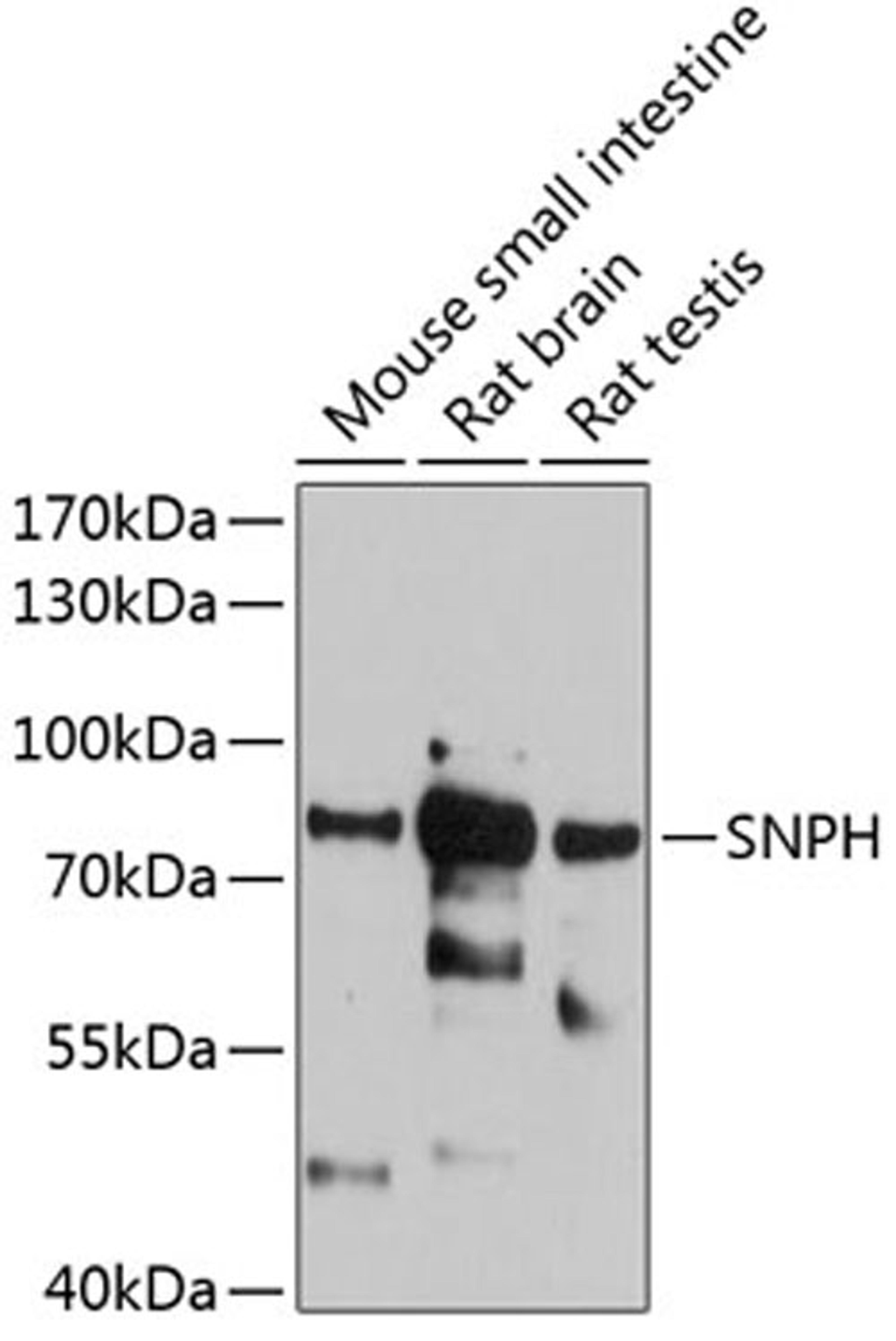 Western blot - SNPH antibody (A12300)