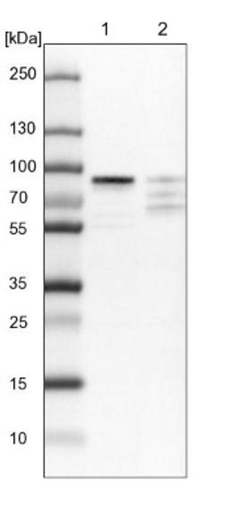 Western Blot: HBO1 Antibody [NBP1-92161] - Lane 1: NIH-3T3 cell lysate (Mouse embryonic fibroblast cells)<br/>Lane 2: NBT-II cell lysate (Rat Wistar bladder tumour cells)