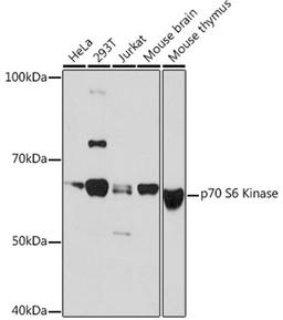 Western blot - p70 S6 Kinase Rabbit mAb (A4898)